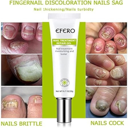ফুল কোর্স - Efero Nail Treatment Repair Gel